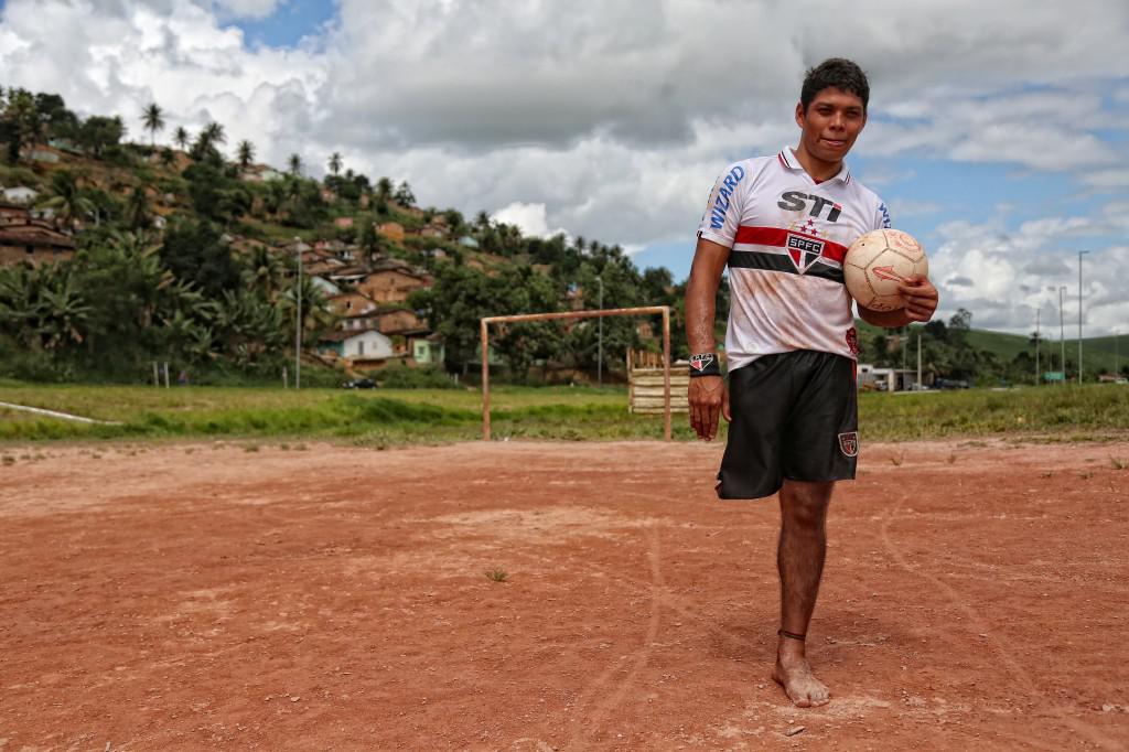 Jefferson Lima, de 21 anos, perdeu a perna direita aos 4 anos de idade Foto: Guga Matos/JC Imagem