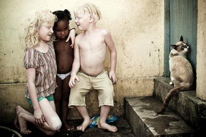 Irmãos albinos foram imortalizados em fotografia genial. Foto: Alexandre Severo