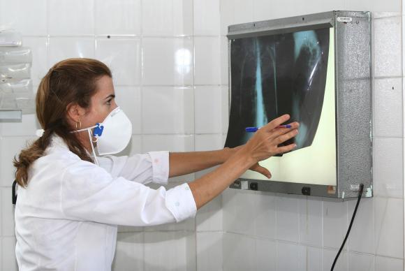 O Brasil tem 6 milhões de casos de tuberculose todo ano e mais de 1 milhão de mortes. Foto: Agecom Bahia